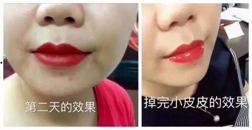 马蹄唇国产图片对比视频,马蹄唇国产图片与视频对比解析